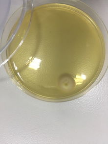 霉菌与食品微生物检测 Discuz技术平台在微生物检测中的应用与前景