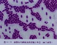 食品微生物检验 守护餐桌安全的关键技术